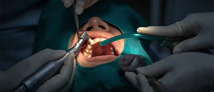 Bone grafting surgery clinic in karama