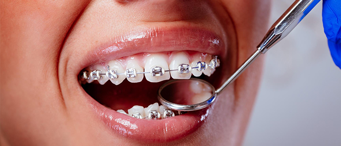 best orthodontist in karama