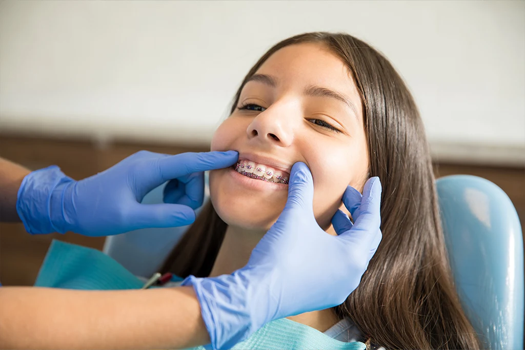 Can Wearing Braces Change the Structure of Your Jawline?