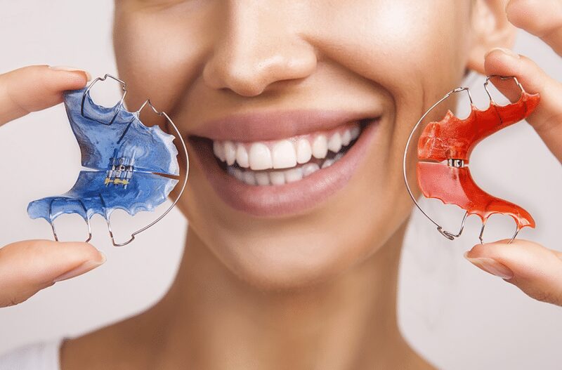 The Importance of Retainers After Orthodontic Treatment