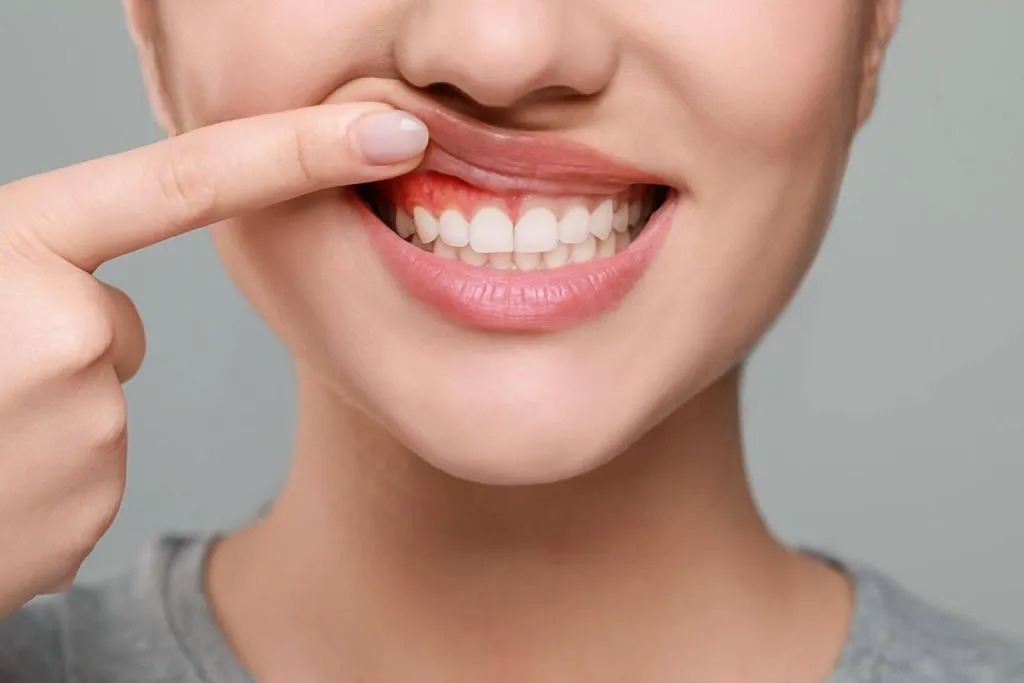 How Gum Treatment Restores Oral Health and Prevents Tooth Loss