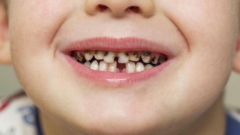 Pediatric Dental Health