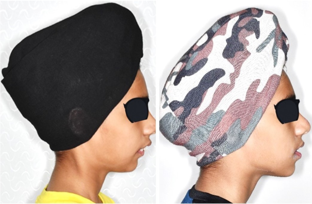 Jaw Growth in Children